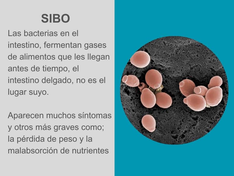 SIBO